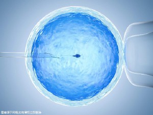 胚胎培养箱